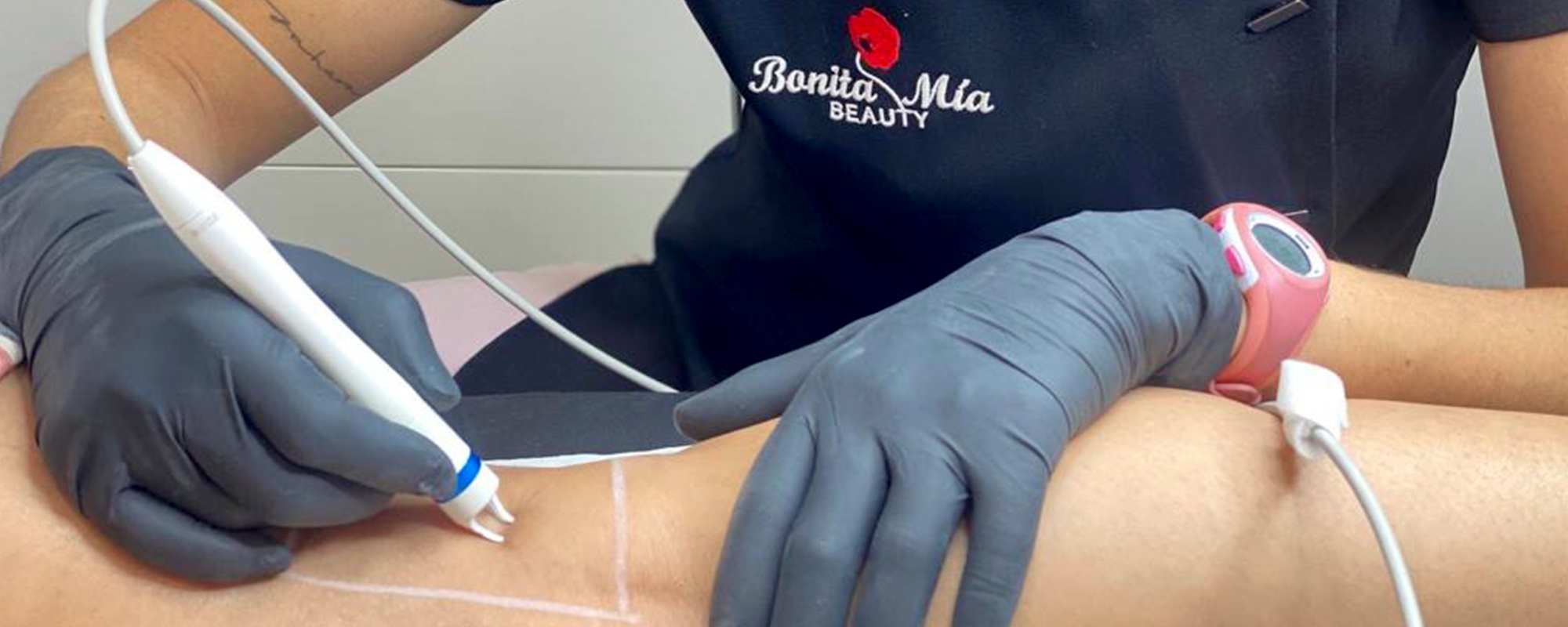 eliminar arañas vasculares