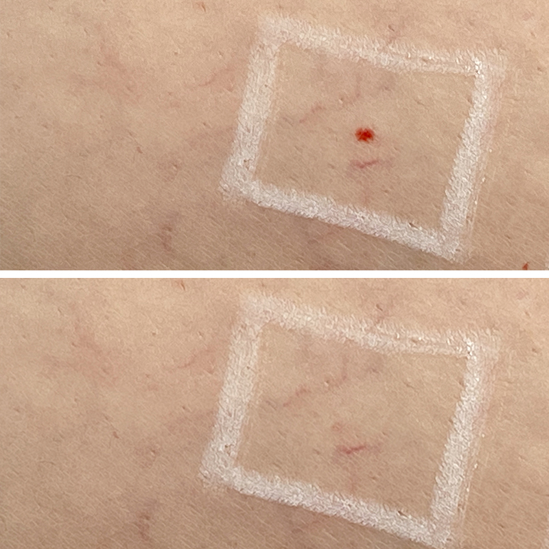 puntos rubi eliminar definitivo